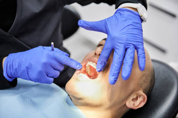 Best Emergency Dental Care for Broken or Chipped Teeth in Morgantown, WV