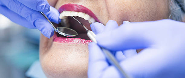 Best Urgent Care for Lost Fillings or Crowns in Morgantown, WV